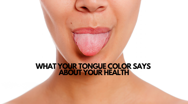 What Your Tongue Color Says About Your Health